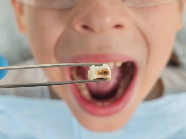 Best Tooth Pain Emergency Relief  in Sault Ste Marie, MI